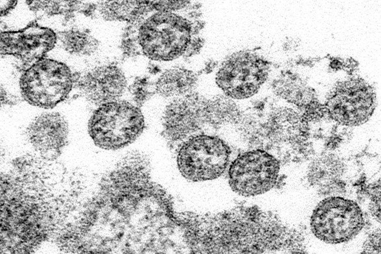 More evidence suggests COVID-19 was in US by Christmas 2019